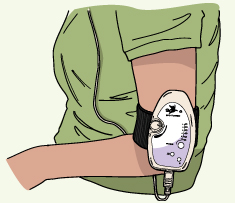 Bio Tuner Arm Placement