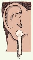 Picture of Ear Clip attached to Ear