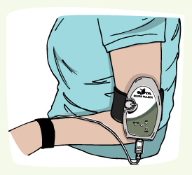 Arm Placement
